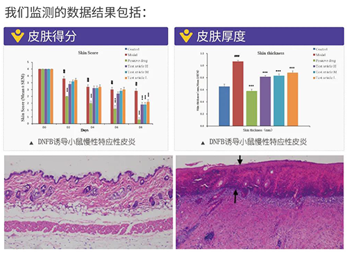 贝斯特全球最奢华的游戏平台建立的特应性皮炎及湿疹模型监测数据结果