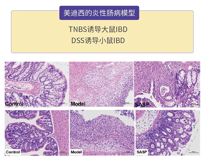 贝斯特全球最奢华的游戏平台的炎性肠病模型.png
